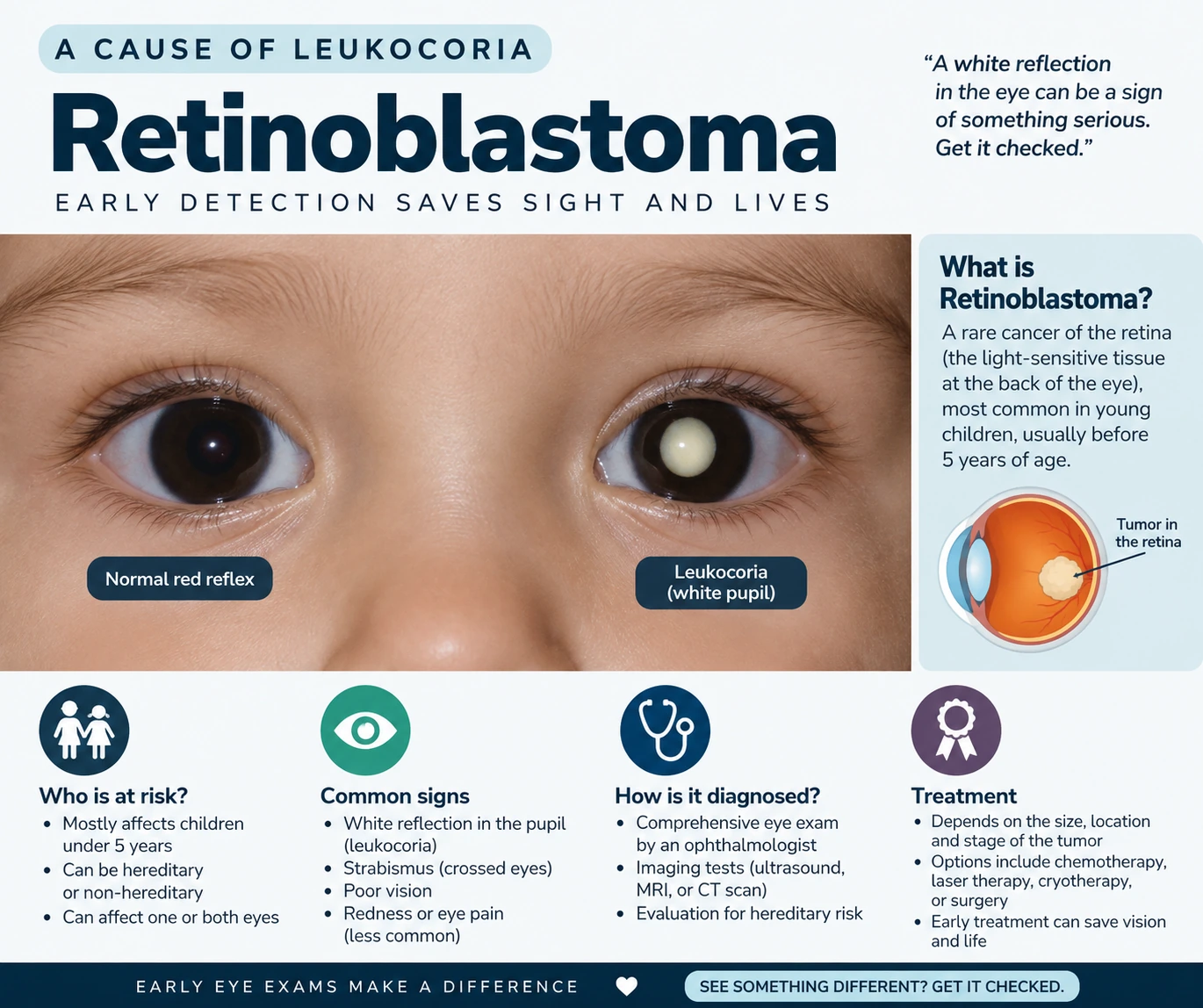 Any sign of leukocoria requires an immediate, thorough evaluation by an eye specialist
